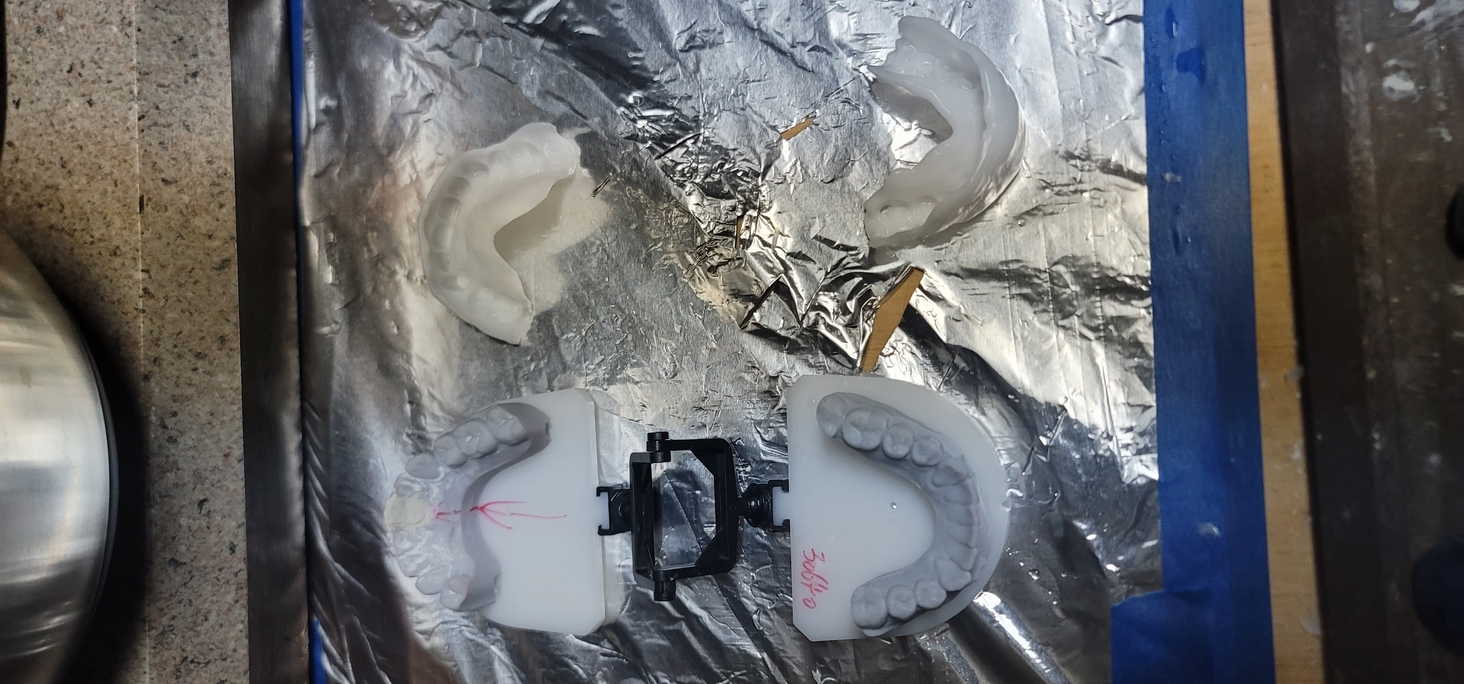 just had a crown done, they let me keep the "jaws" that they used to test the crown fit.


I used a UV cure dental composite (amazon won't sell you the stuff without a license but Ebay will)  to make a crown for each tooth and cured it.